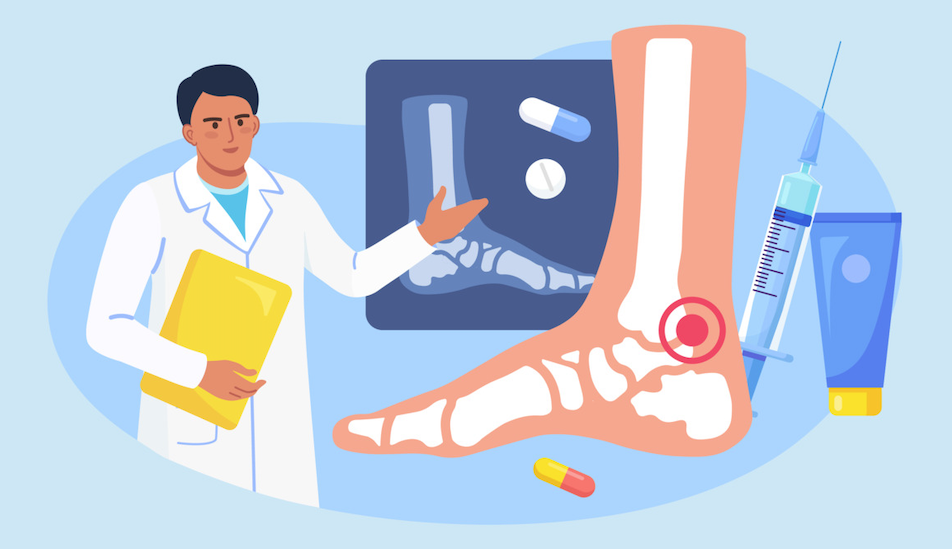 Ankle Pain Differential Diagnosis - Newman Feet