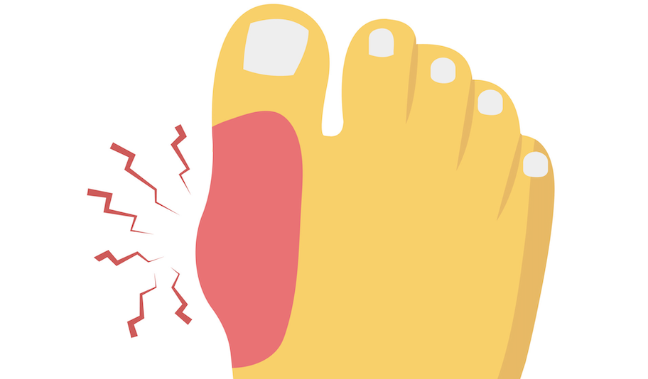 causes-of-pain-on-top-of-big-toe-joint-newman-feet