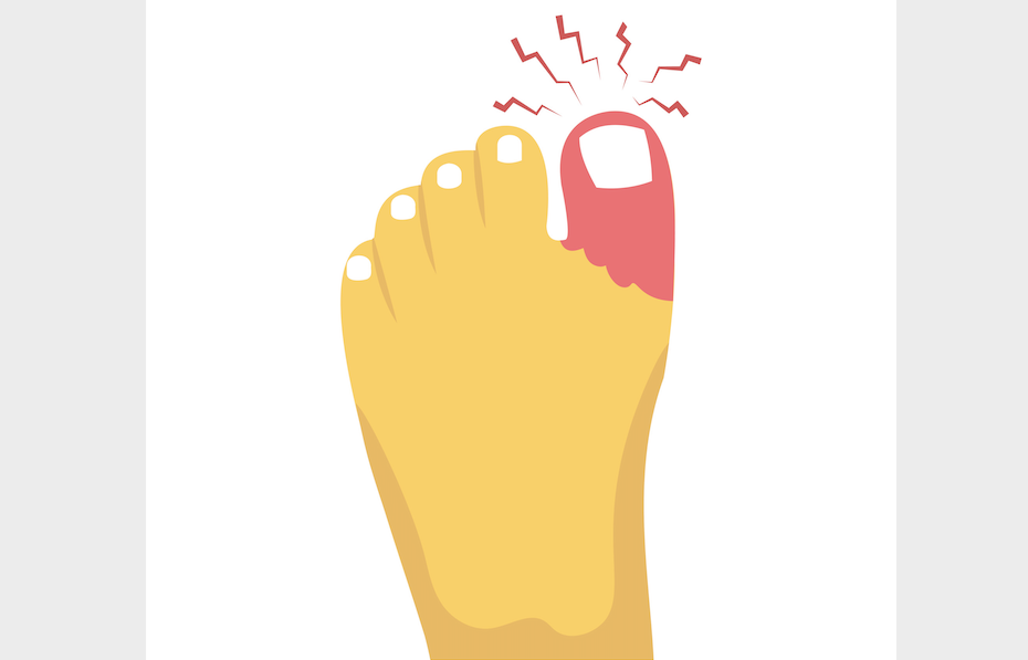 Causes of sharp stabbing pain in the big toe? Newman Feet