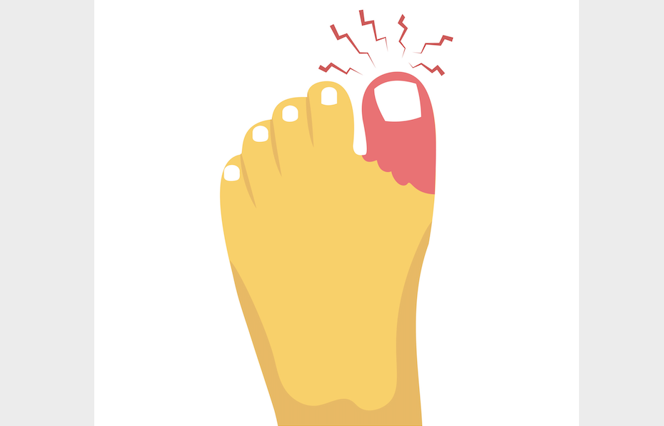 What Can Cause Shooting Pain In Your Big Toe