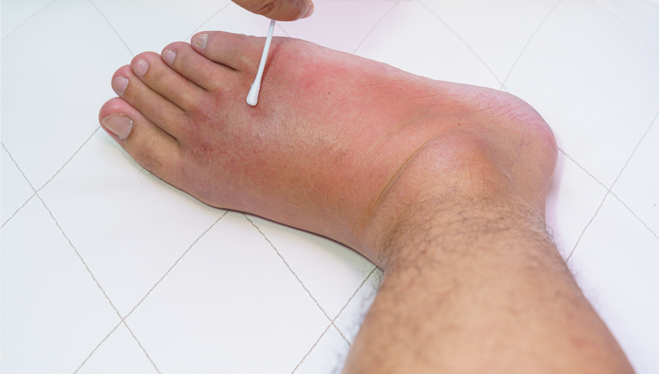 why-are-my-feet-swollen-what-causes-it-vionic